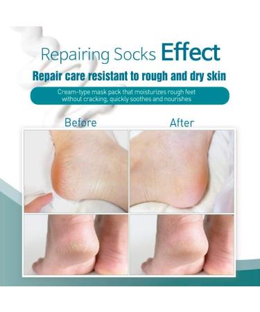 Epielle Intensive Repairing Foot Mask (Socks-6pk) | Coconut Oil + Milk Extract + Hyaluronic Acid | For Dry, Cracked Heels & Calluses | Foot Spa Treatment | Stocking Stuffer - Buy Online on GoSupps.com