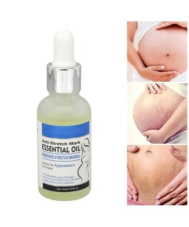 Dekaim 30ml Stretch Mark Essential Oil - Nourishing & Moisturizing Serum for Effective Stretch Mark Removal | Shop Internationally - Buy Online on GoSupps.com