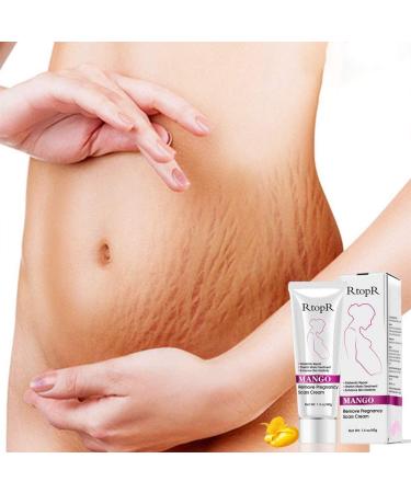 RTOPR Mango Cream for Pregnancy Scars Acne and Stretch Marks - Effective Treatment - Buy Online on GoSupps.com