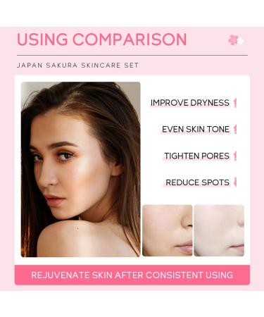Sakura Skincare Gift Set - 5pcs Travel Kit with Cleanser Toner Serum Eye Cream & Face Cream for Women & Girls | International Shipping - Buy Online on GoSupps.com