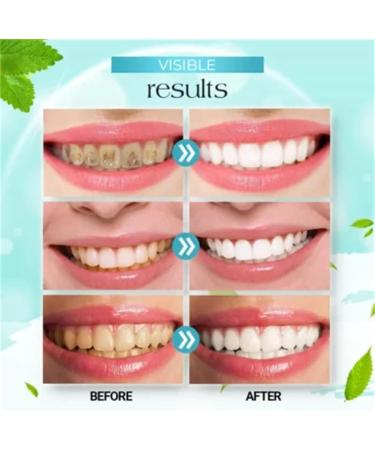 New Teeth Whitening Mouthwash - 2024 | 360 Gum Health Care & Deep Cleaning Foam (3 PCs) - Buy Online on GoSupps.com