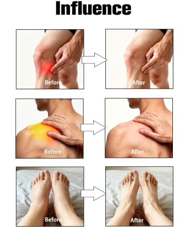 EdenEdges Capsaicin Neuropathy Relief Cream | Enriched with Capsaicin Arnica Menthol | Soothing Massage Balm for Feet Hands Legs & Lower Back - Fast Absorbing Muscle & Joint Care - Buy Online on GoSupps.com