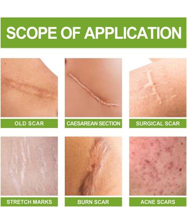 Allayu Leg Chest Stretch Mark Removal Serum Body Burn Scars Serum Girls Repair Essence Beauty Supplies - Buy Online on GoSupps.com
