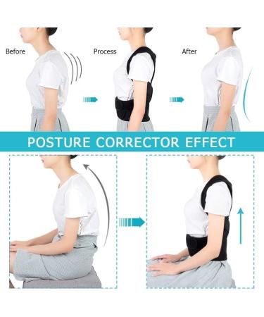 Adjustable Scoliosis Posture Corrector Full Back Support Corset for Men Women Shoulder Neck Clavicle Spine Support Lumbar Support L B - Buy Online on GoSupps.com