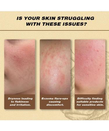 Ofanyia Beef Tallow for Skin Grass Fed Whipped Beef Tallow Cream Beef Tallow Moisturizer for Face & Body Tallow Balm for Skin Hydration - Buy Online on GoSupps.com