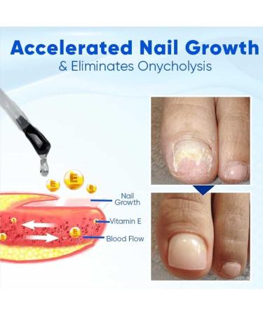 OnyxoGuard Nail Growth and Repair Serum Serum Nail Strengthener Nail Strengthening and Growth for Thin Nail Brittle & Damaged Strengthener Base Coat Nail Polish Repair Nail Growth Treatment (3Pcs) - Buy Online on GoSupps.com