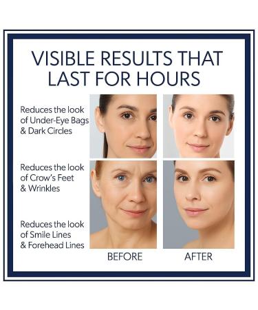 Instant Firming Eye Serum Reduces Under-Eye Bags Wrinkles Dark Circles Fine Lines & Crow's Feet Anti-Aging Wrinkle Remover | 10ml 0.35 oz - Buy Online on GoSupps.com