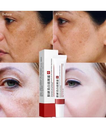 Dark Spot Remover Cream with Alpha Arbutin, Niacinamide, Collagen - for Face, Body & Sensitive Areas- Vitamin E, Bearberry, Vitamin A- Age & Sun Spot Corrector - Buy Online on GoSupps.com