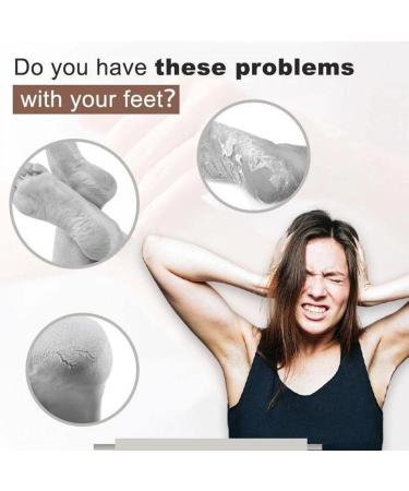 Suho Skin Healing Ointment for Cracked Heels & Dry Feet | Best Anti-Crack Hand & Foot Cream | Repair Calluses & Dead Skin - International Shipping - Buy Online on GoSupps.com