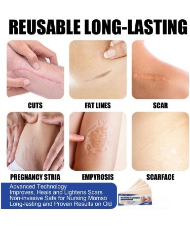 4Pcs Silicone Scar Repair Patch - Lighten Pigmentation, Odorless, Effective Skin Repair - Color S - Buy Online on GoSupps.com