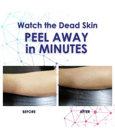 Anti Aging 3D Minute Skin Renewal Face Mask - NASA Stem Cell Technology for Softer Smoother Radiant Skin | 8 Weeks Supply (1.7oz - Buy Online on GoSupps.com