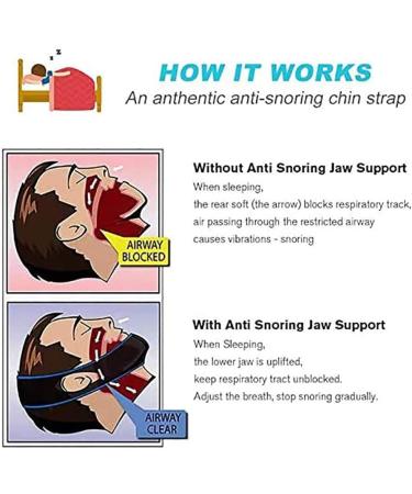 Anti Snoring Chin Strap - Comfortable & Effective Snore Stopper for Men and Women | Natural Sleep Aid & Snore Reducing Device - Buy Online on GoSupps.com