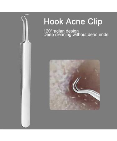 Rnitle Blackhead Remover Set - Stainless Steel Comedone Squeezer for Acne & Whiteheads - Effective Blackhead Removal for All Skin Types - Buy Online on GoSupps.com