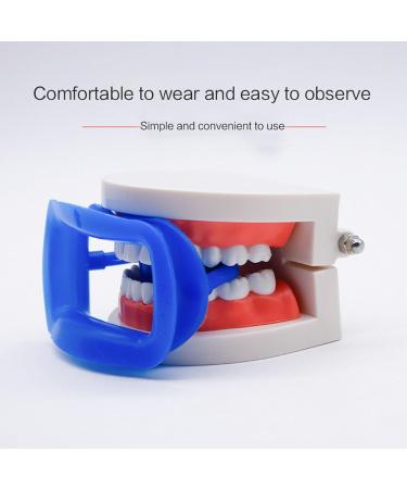 Gissroys Cheek Roller - Food-Grade Silicone Jaw-Friendly Mouth Opener for Dental Care | Shop Internationally - Buy Online on GoSupps.com