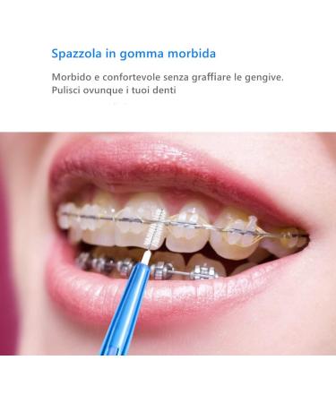 Rosenice Interdental Brushes 1.5 mm with Telescopic Handle - 60 Pack for Orthodontic Oral Hygiene - Buy Online on GoSupps.com