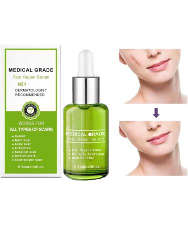 Goopgen Advanced Scar Repair Serum - Medical Grade Scar Removal Treatment for All Types of Scars (2Pcs) - Buy Online on GoSupps.com