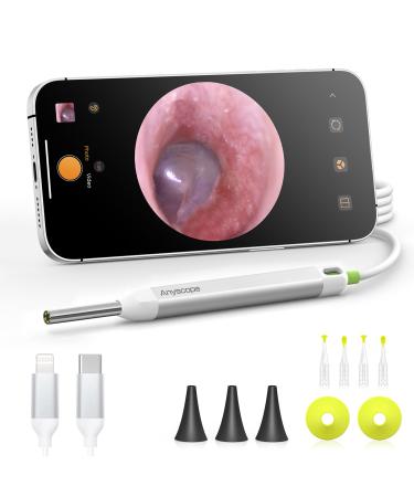 AnyScope Digital Otoscope with Gyroscope HD Ear Camera with Ear Wax Removal Tools Video Ear Scope Otoscope with Light Compatible with iPhone and Android (Silver)