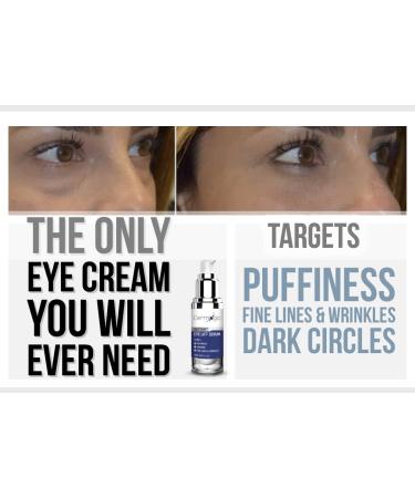 Under Eye Rapid Treatment - Reduce Puffiness & Dark Circles, Tighten & Firm Skin - For Men & Women - Buy Online on GoSupps.com