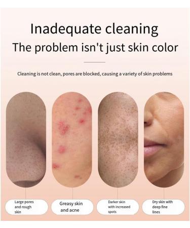 Dewedrt Electric Blackhead Remover Face Pimple Extraction Deep Spots Pore Acne Removal Cleaner Cleanser - Buy Online on GoSupps.com