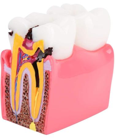 Comprehensive Caries Studies & Oral Hygiene Resources for Dentists - Preventive Care Education - Buy Online on GoSupps.com