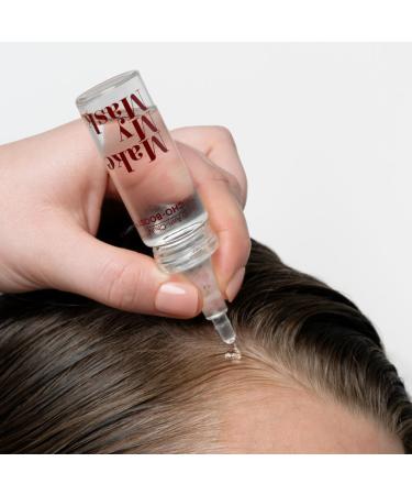 S rum Anti-Chute Capillaire Brevet 98% Naturel 20mL Pour Hommes et Femmes Alternative Naturelle au Minoxidil pour Alop cie Calvitie Alop cie Androg n tique pousse cheveux