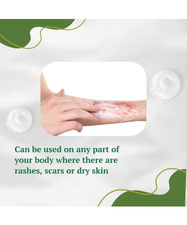 Aloe Vera Cream for Dark Spot Removal | Blemish Treatment & Scar Reducer | Face Cream for Men Women & Kids - Buy Online on GoSupps.com