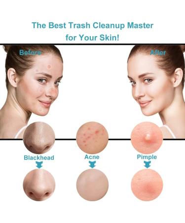 Pimple Popper Tool Kit - VBoo Extraction Tools for Blackhead & Whitehead Removal - Comedone Zit Popper Set for Facial Pore Cleansing - Perfect Christmas Gift for Men and Women (Rainbow) - Buy Online on GoSupps.com