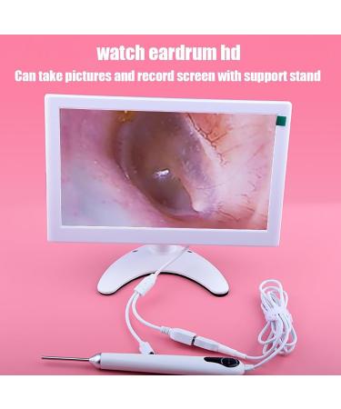 Professional Digital Otoscope Ear Wax Camera - 10 HD Display 3.2mm Lens 10MP Image & Screen Recording - Ideal for Adults | International Shipping Available - Buy Online on GoSupps.com