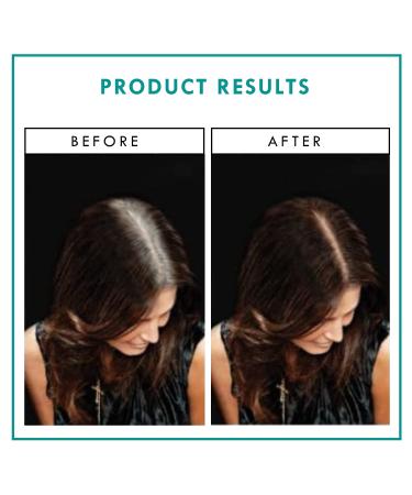 Rita Hazan Root Concealer Touch Up Spray - Dark Brown/Black - 2 oz | Quick Drying Water-Resistant Formula | Temporary Hair Color Spray for Gray Roots - Buy Online on GoSupps.com