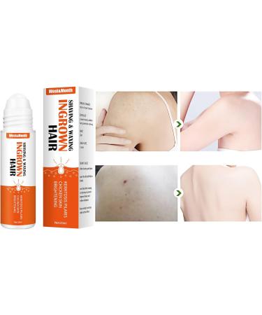 Mombiy Burns & Shave Bump Solution - Care for Ingrown Hair & Skin Irritation | White Unit Size - International Shipping Available - Buy Online on GoSupps.com