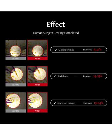 MEDITHERAPY Shumage Retinol 550 Deep Shot Patch - Wrinkle Care Facial Patches with Retinol & Bakuchiol | 11 Lines & Smilelines | Korean Skincare - International Shipping Available - Buy Online on GoSupps.com