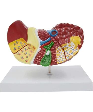 Liver Damage ical Model Liver Pathology Models Teaching Aids - 22.5 * 17 * 16CM