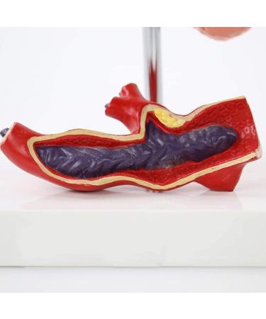 Diabetic Heart Kidney Organ Model PVC Diabetes Pathology Model 5 Removable Parts Eyeball Hear Kidney Vessel Foot Thrombosis Diabetic Fundus School Education Learning Collectibles - Buy Online on GoSupps.com
