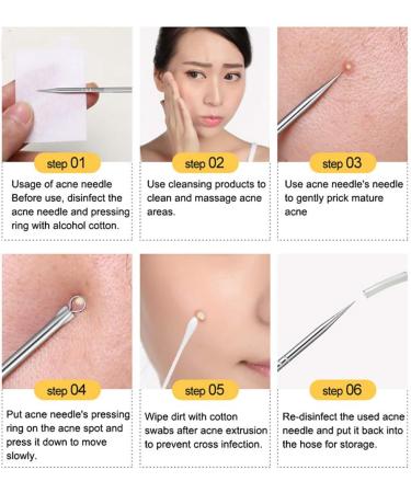 NIUTA Blackhead Remover Tool Kit - Acne Needle Extractor for Facial Cleaning - Silver (Pack of 4) - Buy Online on GoSupps.com