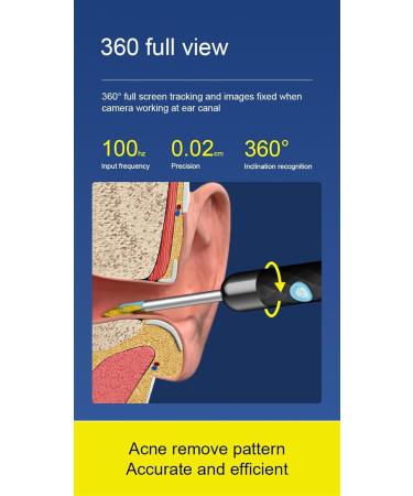 Premium Ear Wax Removal Kit with 1080P Camera - Ear Cleaner & Otoscope for iPhone & Android - Buy Online on GoSupps.com