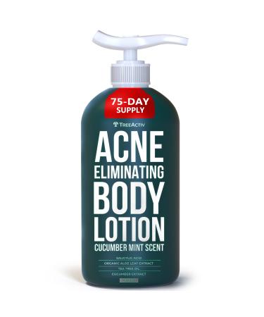 TreeActiv Acne Eliminating Body Lotion - Cucumber Mint Scent  2% Salicylic Acid Moisturizer Lotion - Body Acne Treatment And Butt Acne Clearing Treatment for Women and Men  Non-GMO