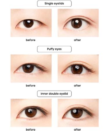 SePkus Invisible Eyelid Strips Kit Double Sided Breathable Natural Mesh Eyelid Tape. (M) Medium - Buy Online on GoSupps.com