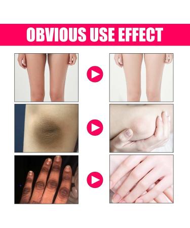 Pure Feminine Intimate Area Whitening Essence | 2024 New Pinkish Formula for Private Parts | Intimate Area Whitening Cream (2PC) - Buy Online on GoSupps.com