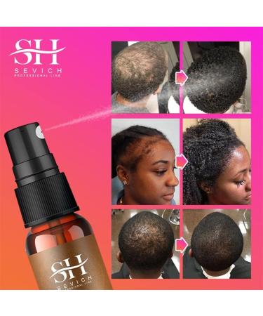 SEVICH Naturals Chebe Hair Growth Spray - 100% African Chebe Essence Thin Loss Hair Treatment Moisture&Repair Damaged Hair Root Scalp Skin Refresh 30ml - Buy Online on GoSupps.com