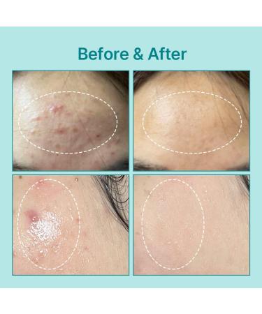 Centella Asiatica Face Moisturizer - Soothing & Repairing Cream for Sensitive Skin - Vegan & Cruelty-Free Korean Skincare (1.7 Fl oz - Buy Online on GoSupps.com