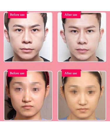 V Face Slimming Belt - Ultra-Thin Face Lifting Strap to Reduce Double Chin & Anti-Aging Cheek Bandage | Shop Internationally - Buy Online on GoSupps.com