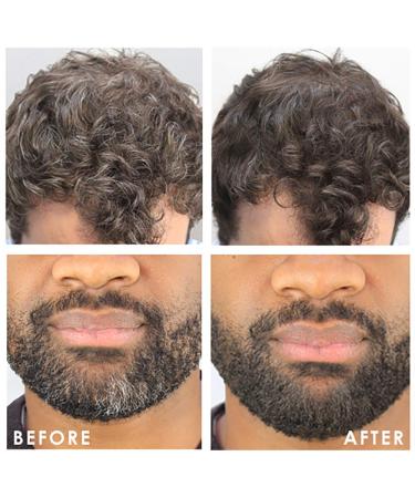 TEMPTU Airpod Airbrush Root Touch-up & Hair Color Kit - Vitamin-Enriched Weightless Formula for Long-Lasting Brown/Black Color | International Shipping Available - Buy Online on GoSupps.com