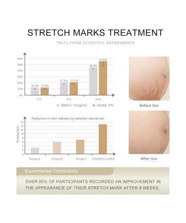 TENDER FLOWER Stretch Mark Oil 110ml | Pregnancy Body Oil & Moisturizing Serum for Dry Skin | True Belly Serum for Softening & Tender Care - Buy Online on GoSupps.com