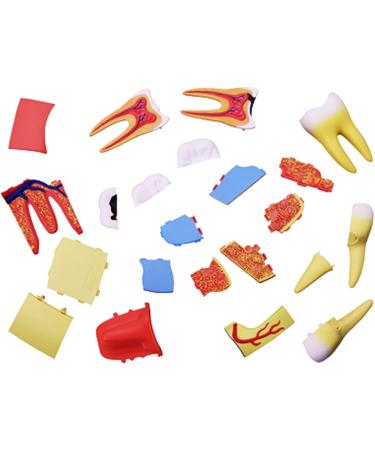 Liusu 4D Human Tooth Anatomy Model - 23-Part Dental Demonstration Puzzle for Medical Education & Training - Buy Online on GoSupps.com