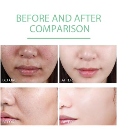 She Eureka Exfoliating Gel She Eureka Exfoliating Gel She Eureka Peeling Gel Herbal Extract Exfoliating Gel Exfoliating Body Scrub (1PC) - Buy Online on GoSupps.com