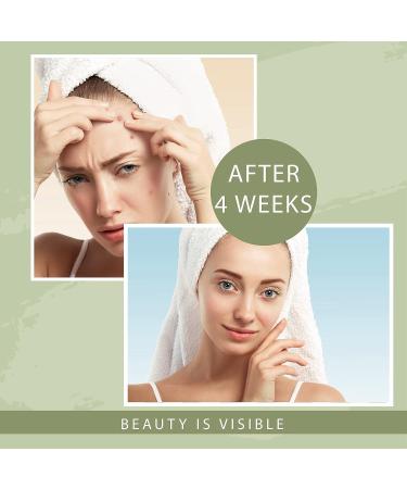 OSITO LED Light Therapy Facial Mask - Acne Treatment & Anti-Aging Red Light Therapy - FSA/HSA Eligible - Unlimited Sessions - White - Buy Online on GoSupps.com