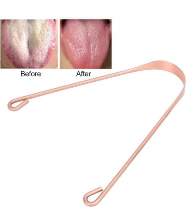 Tongue Scraper - Copper U-Shaped Design for Bad Breath Removal | Durable Oral Hygiene Tool | Easy Cleaning Tongue Cleaner - Buy Online on GoSupps.com