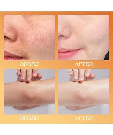 Peel Shot Keratin Care Kojic Acid Turmeric Spray Body and Face Peel Spray Gentle Moisturizing for All Skin Types(200ml) - Buy Online on GoSupps.com