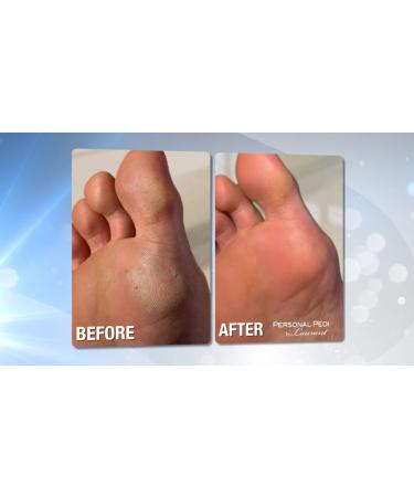 Rechargeable Personal Pedi Foot Callus Remover by Laurant - Smooth, Soft Feet Guaranteed - Buy Online on GoSupps.com