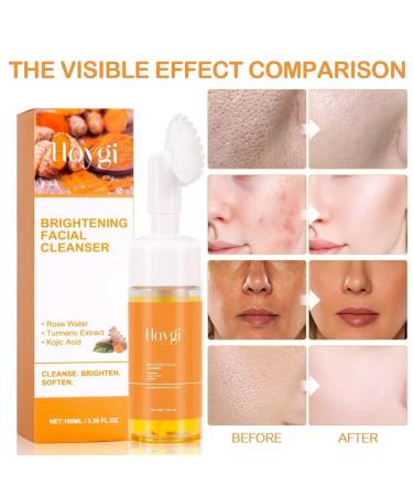 Buy Turmeric Facial Cleanser - Deep Cleansing Foaming Face Wash for All Skin Types | Men & Women | International Shipping Available - Buy Online on GoSupps.com